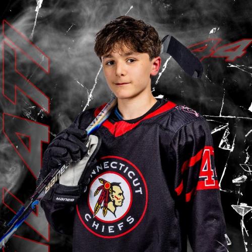 Anthony Galati